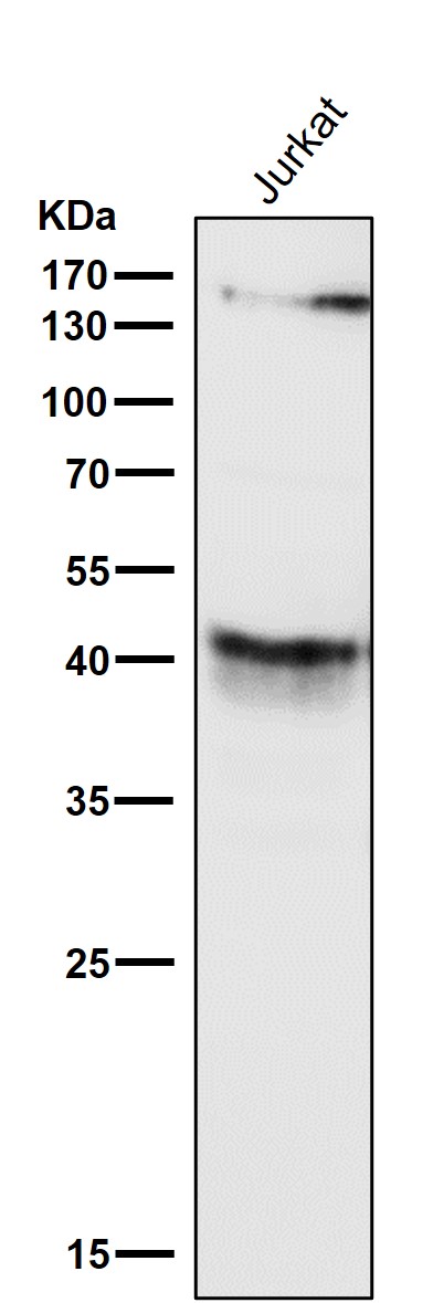 1 - Anti-CD79a Monoclonal Antibody ABO14487