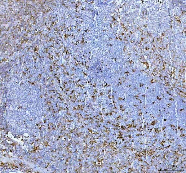 2 - Anti-Fascin Monoclonal Antibody ABO14488