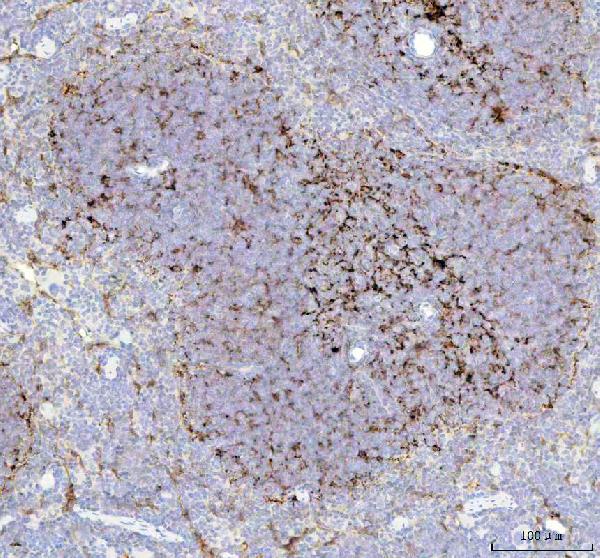 2 - Anti-Fascin Monoclonal Antibody ABO14488