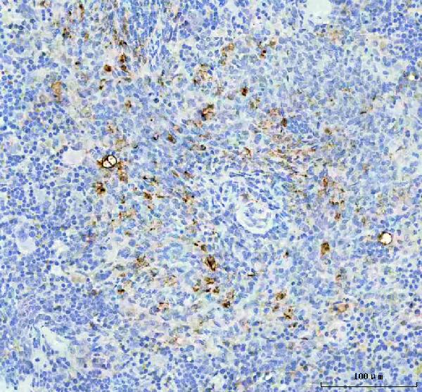 2 - Anti-Fascin Monoclonal Antibody ABO14488