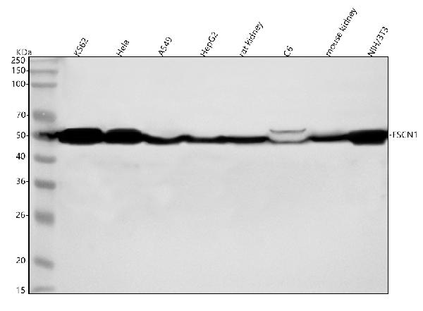 1 - Anti-Fascin Monoclonal Antibody ABO14488