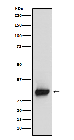 1 - Anti-Calretinin Monoclonal Antibody ABO14491