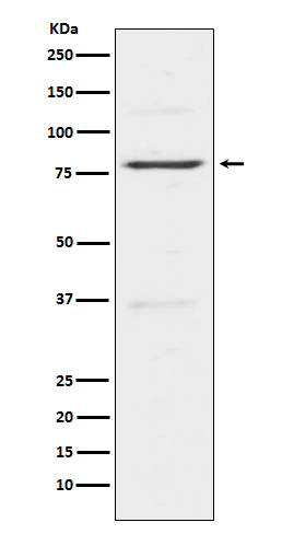 1 - Anti-Insulin Receptor R INSRR Monoclonal Antibody ABO14496
