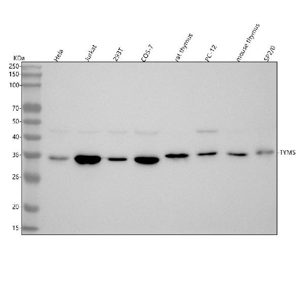 1 - Anti-Thymidylate Synthase TYMS Monoclonal Antibody ABO14498