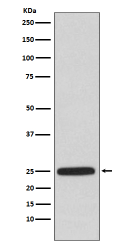 1 - Anti-HPRT HPRT1 Monoclonal Antibody ABO14499