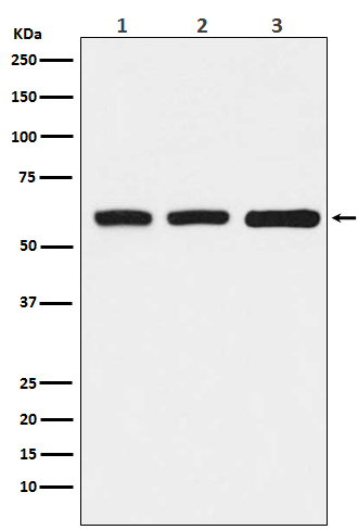 1 - Anti-KAT9 / Elp3 Rabbit Monoclonal Antibody ABO14503