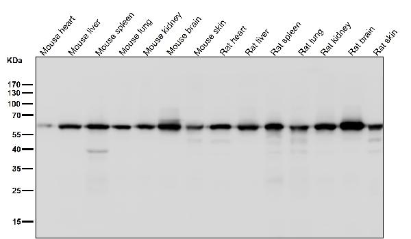 1 - Anti-KAT9 / Elp3 Rabbit Monoclonal Antibody ABO14503