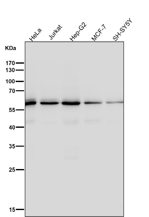 1 - Anti-KAT9 / Elp3 Rabbit Monoclonal Antibody ABO14503