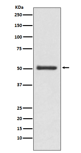 1 - Anti-LOXL2 Rabbit Monoclonal Antibody ABO14511
