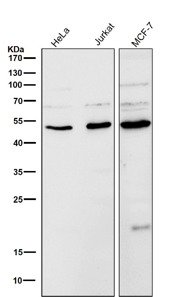 1 - Anti-LOXL2 Rabbit Monoclonal Antibody ABO14511