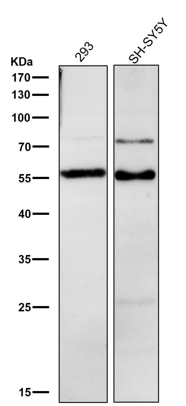 1 - Anti-LOXL2 Rabbit Monoclonal Antibody ABO14511
