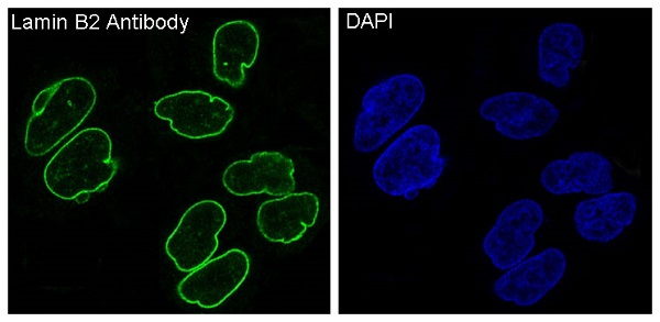 3 - Anti-Lamin B2 Monoclonal Antibody ABO14513