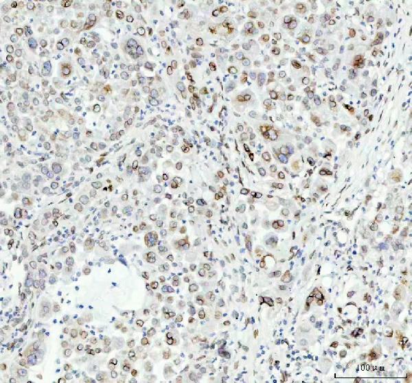 2 - Anti-Lamin B2 Monoclonal Antibody ABO14513