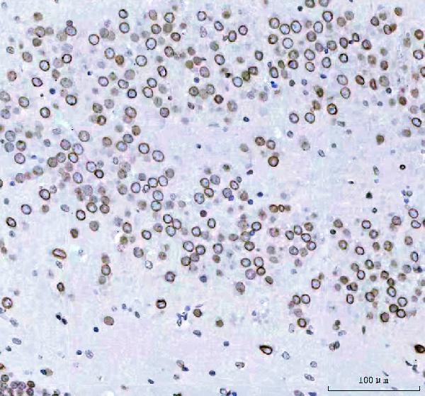 2 - Anti-Lamin B2 Monoclonal Antibody ABO14513