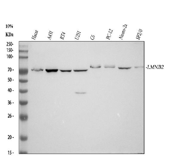 1 - Anti-Lamin B2 Monoclonal Antibody ABO14513