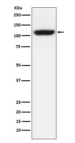 1 - Anti-TRPM8 Monoclonal Antibody ABO14516