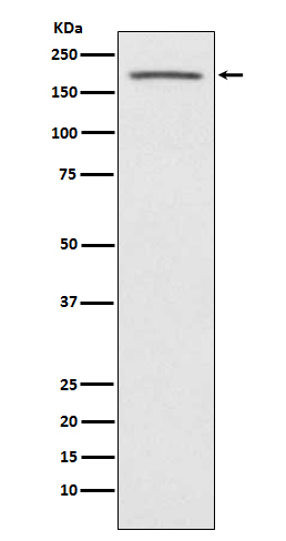 1 - Anti-ACE1 Monoclonal Antibody ABO14517