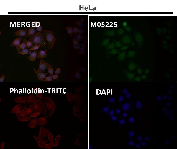 1 - Anti-USP11 Monoclonal Antibody ABO14520