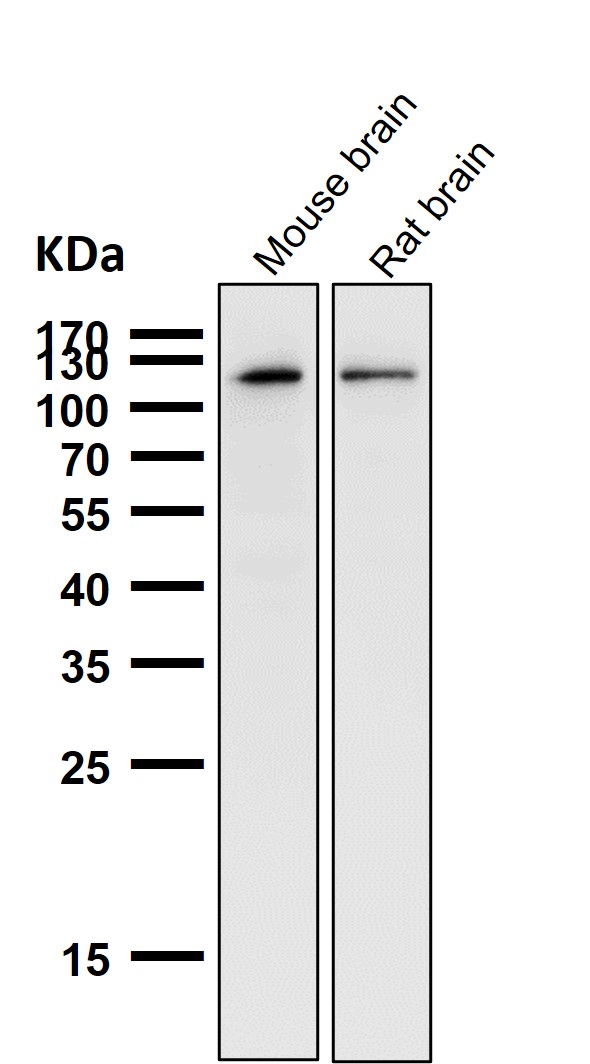 1 - Anti-USP11 Monoclonal Antibody ABO14520