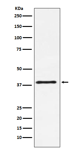 1 - Anti-CTLA4 (CD152) Monoclonal Antibody ABO14521