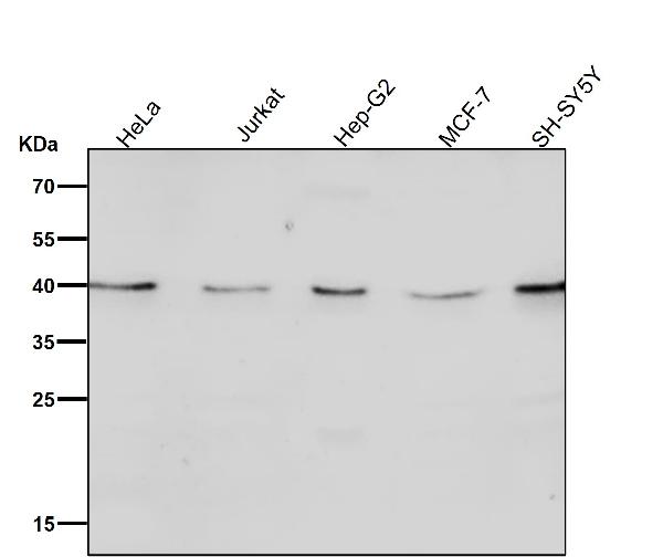 1 - Anti-CTLA4 (CD152) Monoclonal Antibody ABO14521