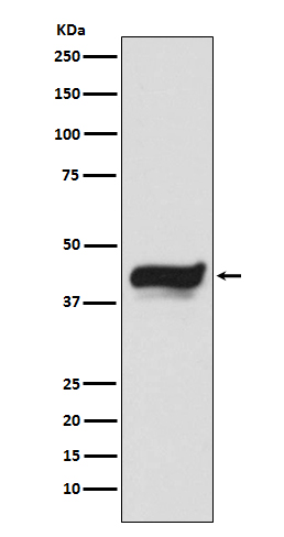 1 - Anti-IKB epsilon NFKBIE Monoclonal Antibody ABO14523