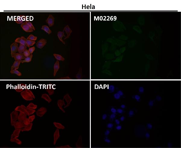 1 - Anti-PI 3 Kinase p110 delta PIK3CD Rabbit Monoclonal Antibody ABO14537