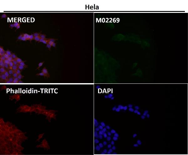 1 - Anti-PI 3 Kinase p110 delta PIK3CD Rabbit Monoclonal Antibody ABO14537