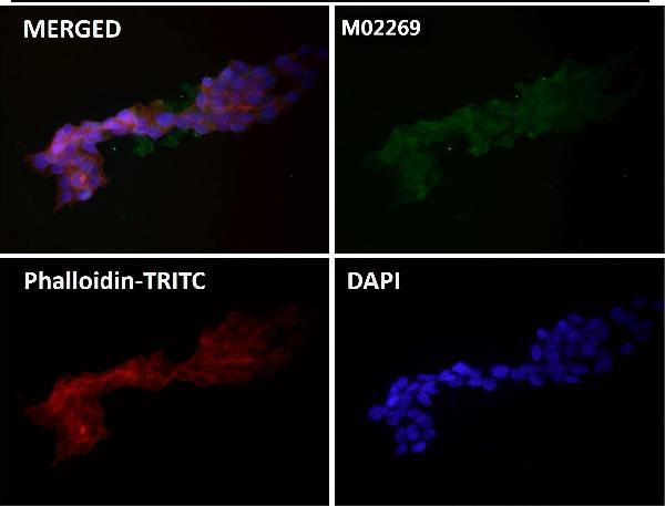 1 - Anti-PI 3 Kinase p110 delta PIK3CD Rabbit Monoclonal Antibody ABO14537