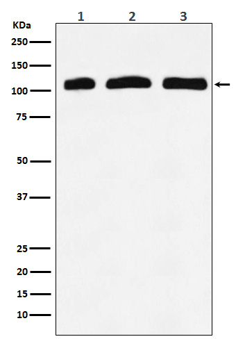 1 - Anti-PI 3 Kinase p110 delta PIK3CD Rabbit Monoclonal Antibody ABO14537