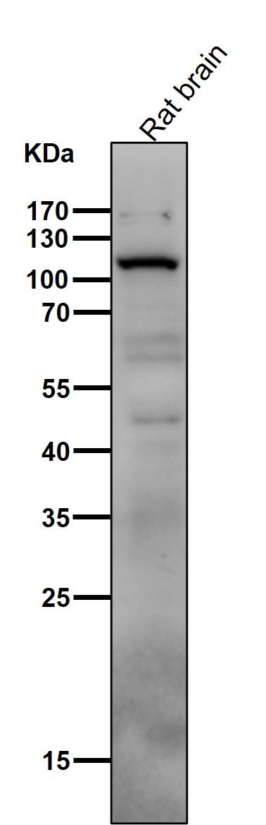 1 - Anti-PI 3 Kinase p110 delta PIK3CD Rabbit Monoclonal Antibody ABO14537