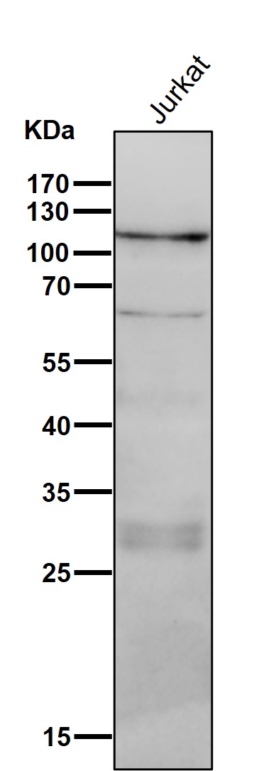 1 - Anti-PI 3 Kinase p110 delta PIK3CD Rabbit Monoclonal Antibody ABO14537