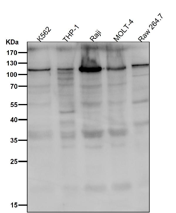 1 - Anti-PI 3 Kinase p110 delta PIK3CD Rabbit Monoclonal Antibody ABO14537