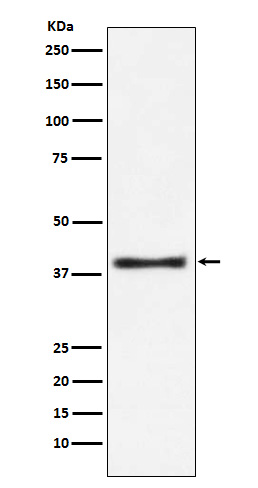 1 - Anti-Aspartate Aminotransferase Monoclonal Antibody ABO14538