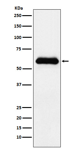 1 - Anti-alpha 1 Antichymotrypsin SERPINA3 Monoclonal Antibody ABO14541
