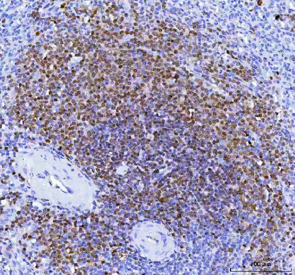 2 - Anti-BOB1 Monoclonal Antibody ABO14545