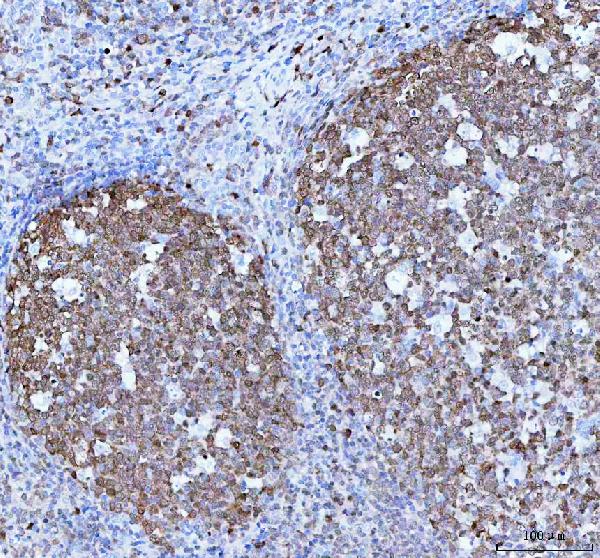 2 - Anti-BOB1 Monoclonal Antibody ABO14545