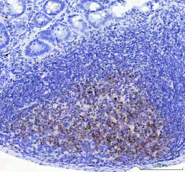 2 - Anti-BOB1 Monoclonal Antibody ABO14545