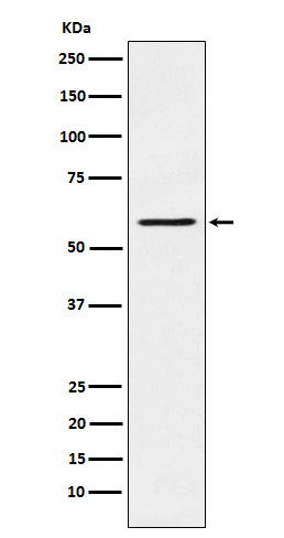 1 - Anti-PAK1 Monoclonal Antibody ABO14547