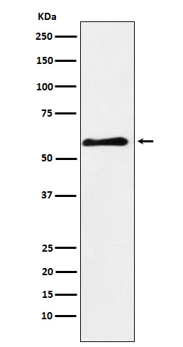 1 - Anti-PAK3 Rabbit Monoclonal Antibody ABO14549
