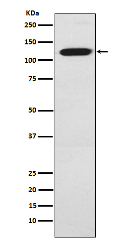 1 - Anti-Ctip1 Monoclonal Antibody ABO14550