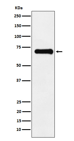 1 - Anti-Phospho-PAK4 + PAK5 + PAK6 (S474 + S560 + S602) Monoclonal Antibody ABO14552