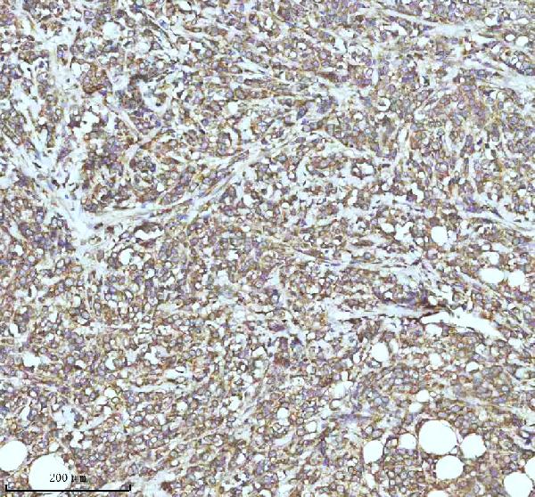 2 - Anti-TRIM25 Monoclonal Antibody ABO14553