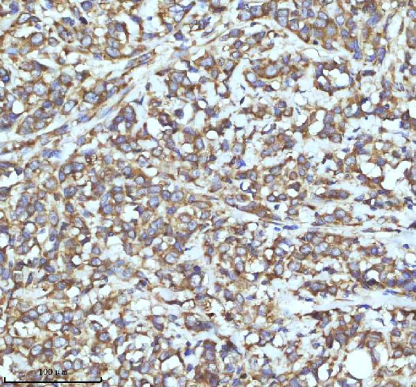2 - Anti-TRIM25 Monoclonal Antibody ABO14553