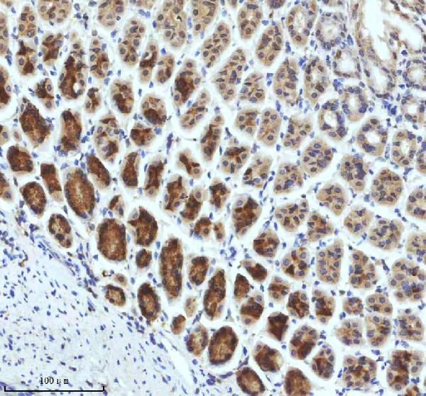 2 - Anti-TRIM25 Monoclonal Antibody ABO14553