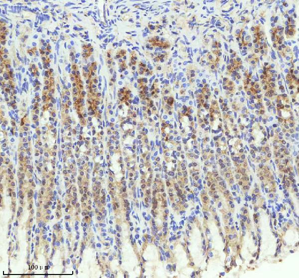 2 - Anti-TRIM25 Monoclonal Antibody ABO14553