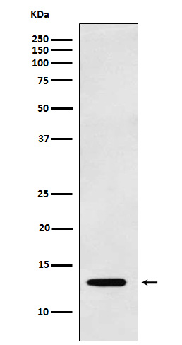 1 - Anti-Galectin 1 LGALS1 Monoclonal Antibody ABO14558