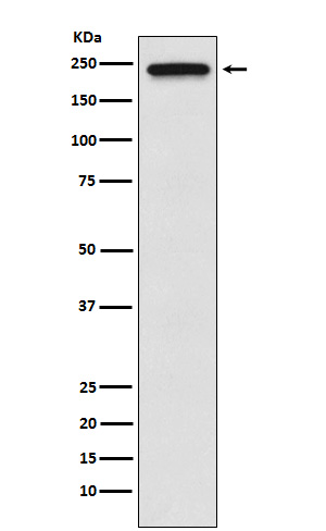 1 - Anti-TRPM7 Monoclonal Antibody ABO14560