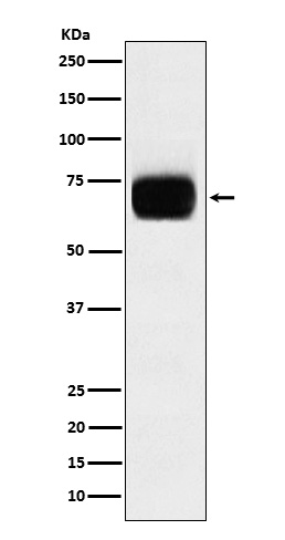 1 - Anti-CD33 Monoclonal Antibody ABO14561