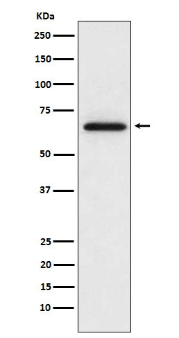 1 - Anti-MMP2 Monoclonal Antibody ABO14562